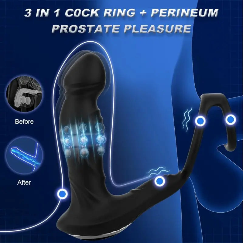 Asura App Control Wiggling & Tapping Prostate Massager with Dual Cock Rings